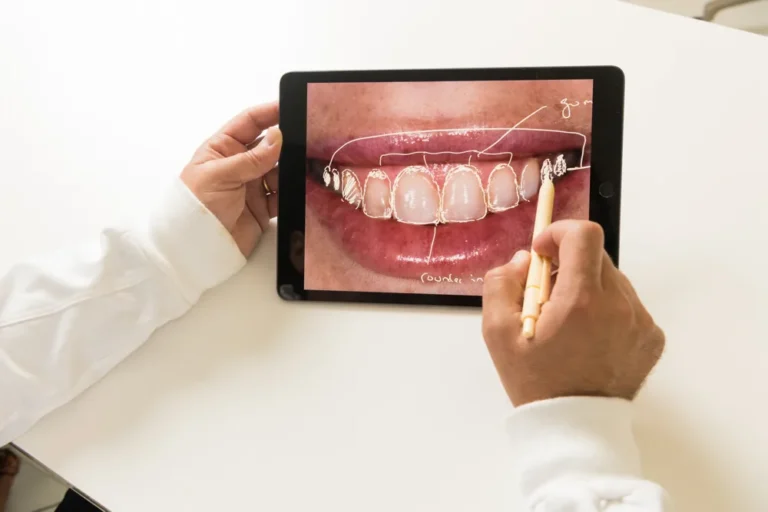 Dentist at Bedford Dental Group drawing proposed tooth proportions over a patient&rsquo;s smile during smile design