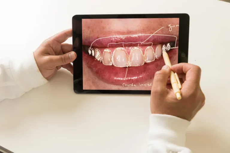 Dr. Daniel Naysan marking proposed veneer shapes over a patient’s smile on an iPad